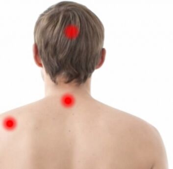 Focos da osteocondrose